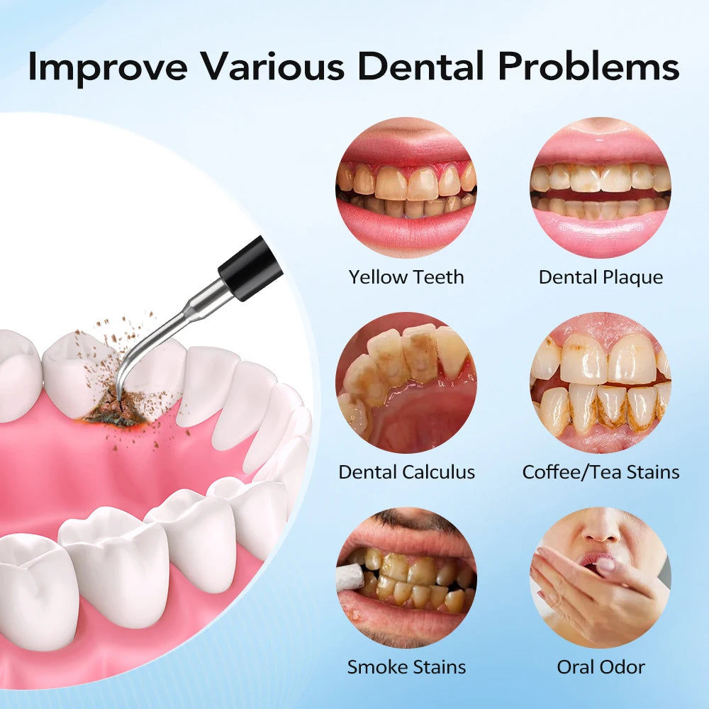 Electric Sonic Teeth Cleaner and Plaque Remover - 11
