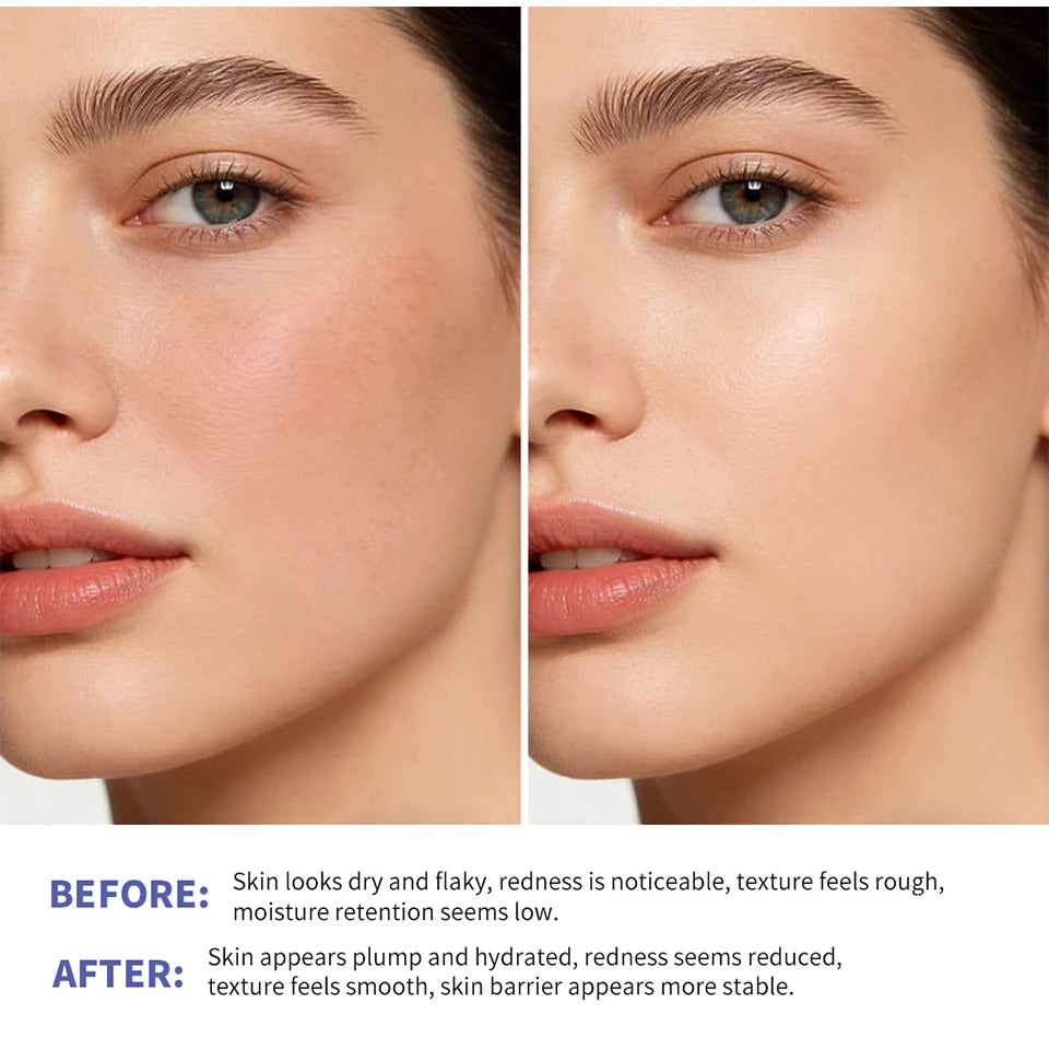 Triple Lipid Peptide Moisturizing Face Cream for Dry Sensitive Skin - 12