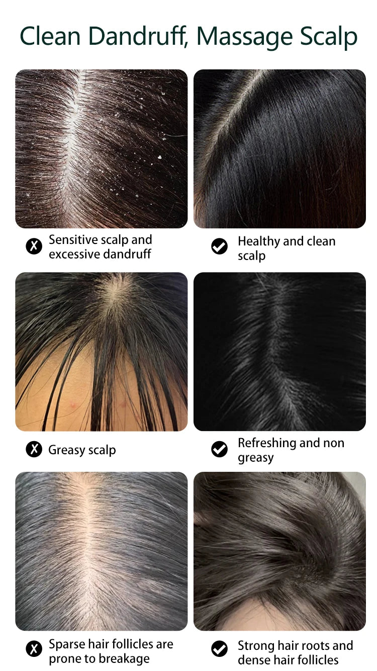 Electric Waterproof Scalp and Head Massager