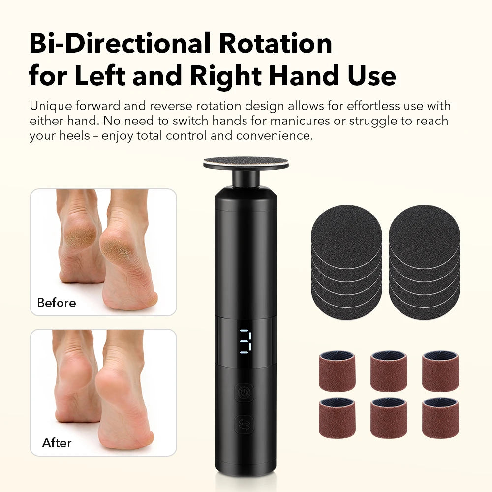 Electric Callus Remover for Smooth Feet and Heel Care - 8