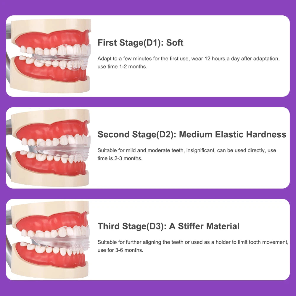 3-Stage Teeth Straightening Alignment Trainer for Adults - 7