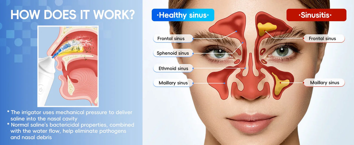 Electric Nasal Irrigation System for Sinus Relief