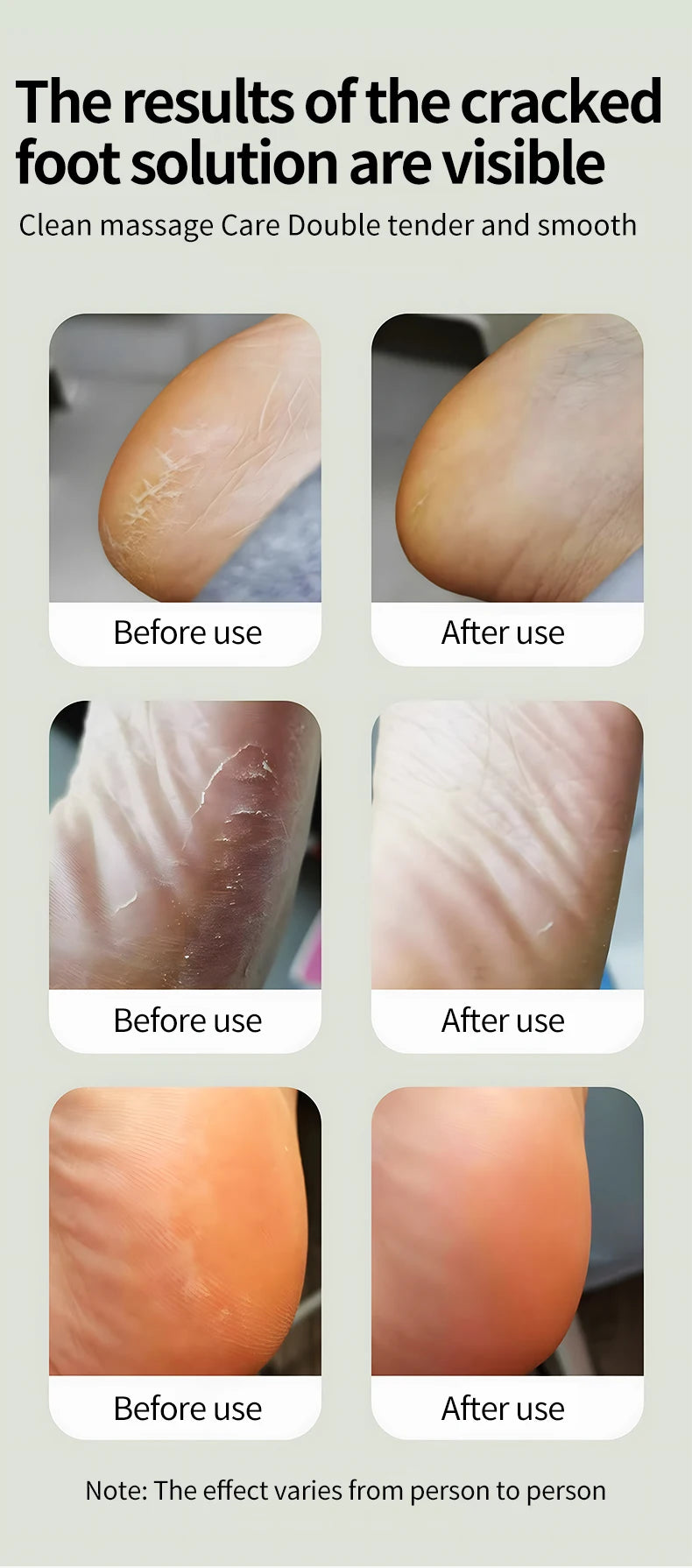 Electric Cordless Foot Callus Remover with 6 Adjustable Speeds