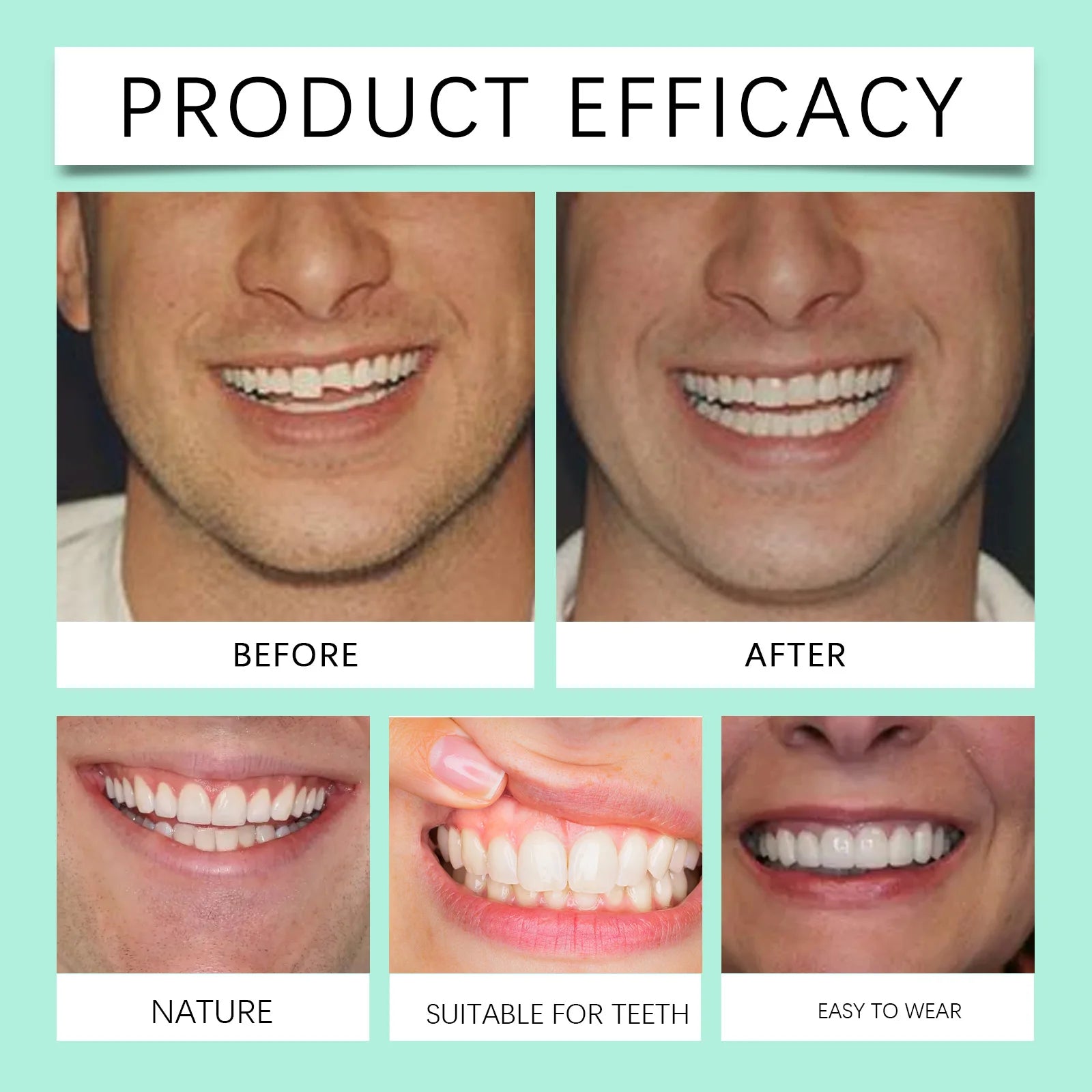 Flexible Silicone Cosmetic Denture Set for Smile Restoration - 12