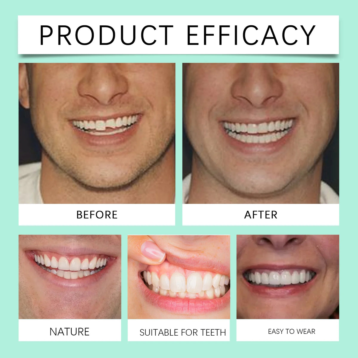 Flexible Silicone Cosmetic Denture Set for Smile Restoration