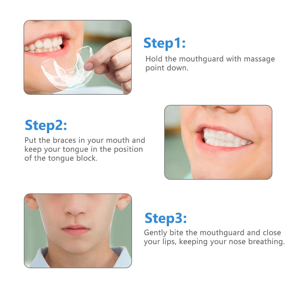 3-Stage Kids Orthodontic Teeth Alignment Trainer Set - 6