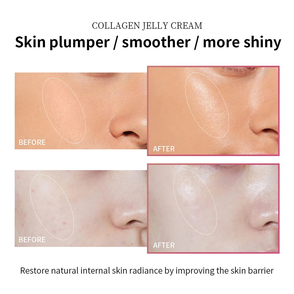 Collagen Hydrating Skincare Kit for Radiant Firm Skin - 25