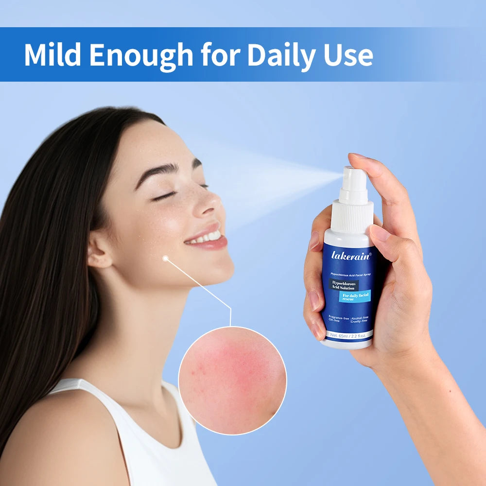 Hypochlorous Acid Soothing Facial Spray for Acne and Sensitive Skin - 1
