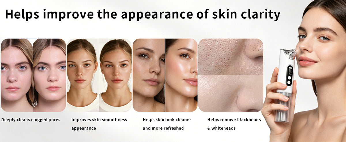 Hydrating Electric Pore Vacuum Blackhead Remover